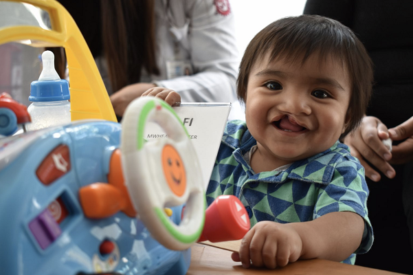 Operation Smile México y J&J Consumer Health van por un cambio