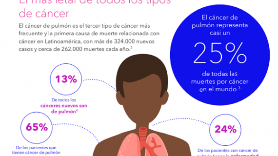 Más del 70% de los pacientes con cáncer pulmonar podrían salvar su vida